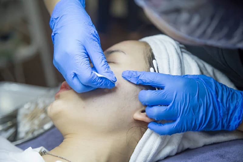 spa điều trị mụn