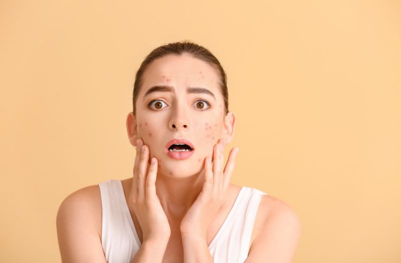 Tác động của da dầu mụn đến lỗ chân lông