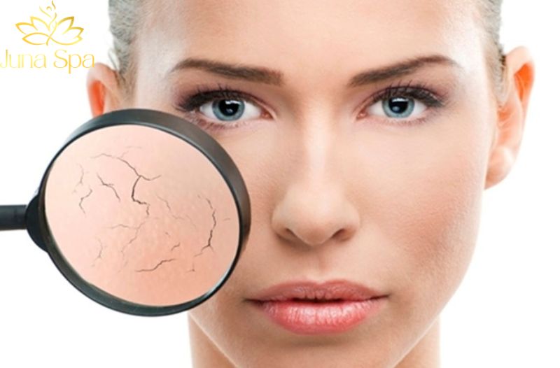 Hàng rào bảo vệ da đang yếu