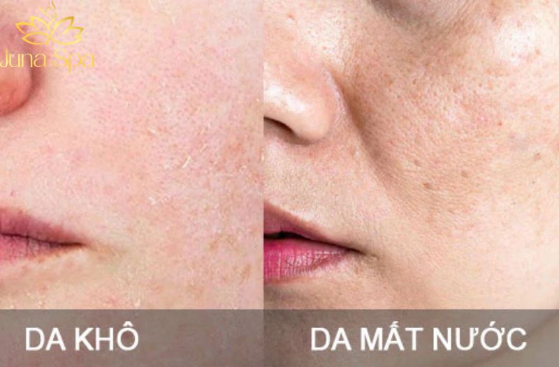 Vì sao da vẫn khô dù đã dưỡng ẩm rất nhiều?